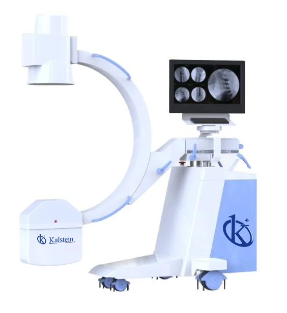 Customization and Advanced Configurations of the YR06165 Mobile High-Frequency C-Arm System for Veterinary Use