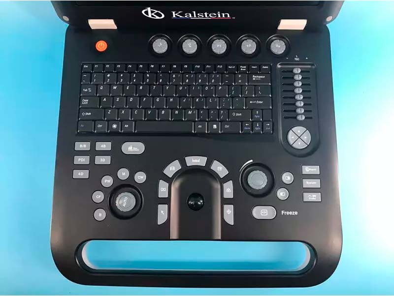 Innovative Ultrasound Scanners: Revolutionizing Medical Imaging with Kalstein