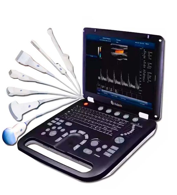 Ultrasound Scanners: High-Definition Medical Imaging