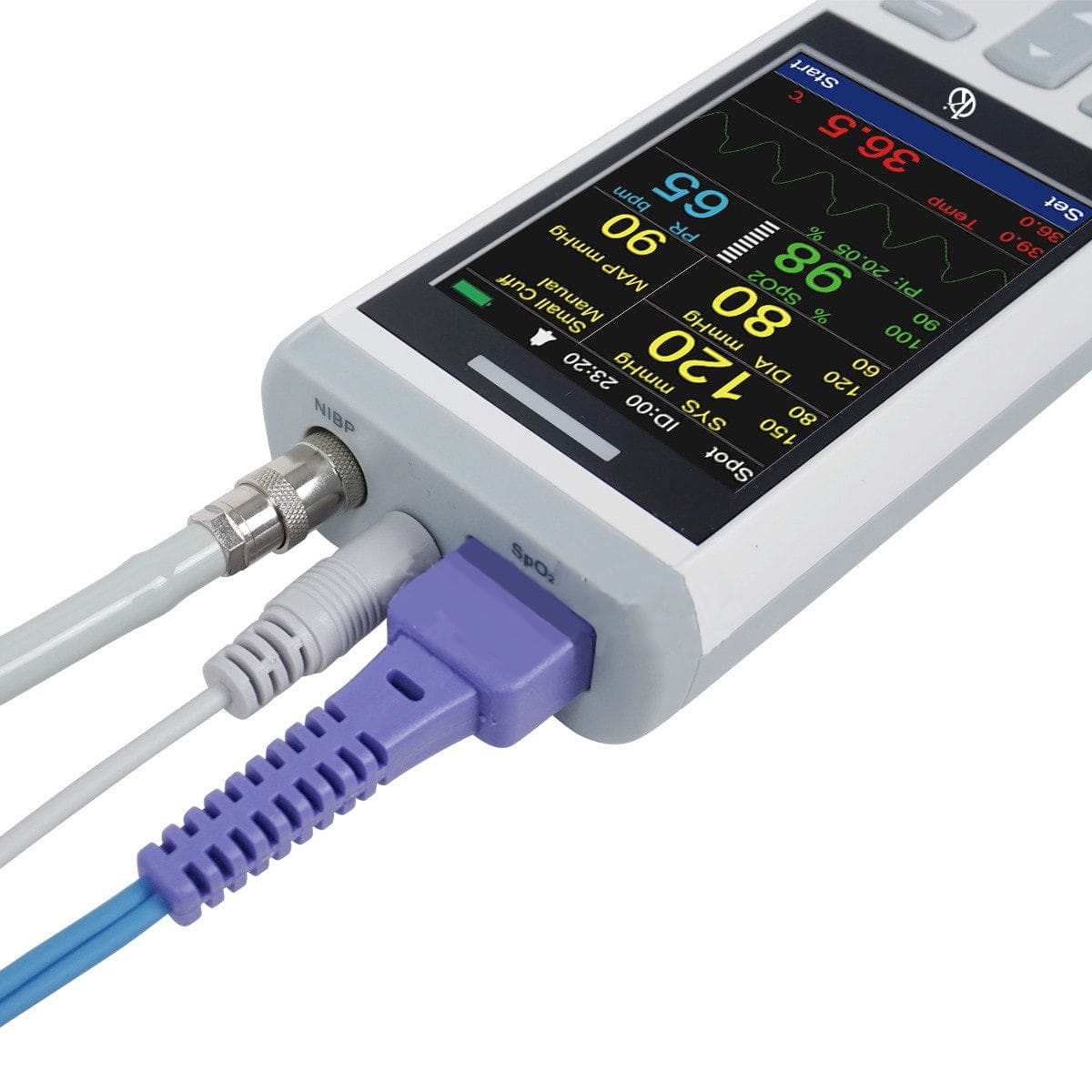 Discovering the Efficiency of Kalstein's Veterinary Monitors