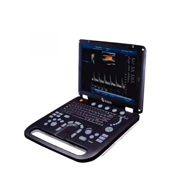 Revolution in Imaging: The New Wave of Ultrasound Scanners